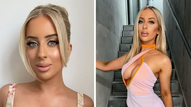 What Cosmetic Work Has MAFS Australia’s Jamie Really Had?