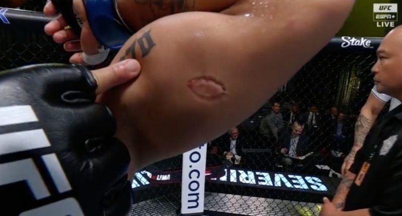 There was a bite fight in the UFC as Igor Severino clamps his teeth onto André Lima
