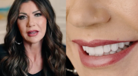 Kristi Noem shares video about dental work Smile Texas