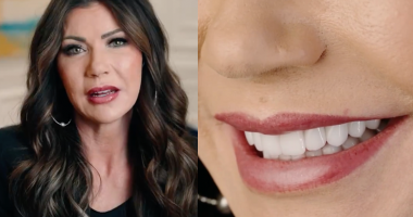Kristi Noem shares video about dental work Smile Texas