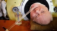 Paul Alexander, Polio Survivor Who Lived in Iron Lung for 70 Years, Dies age 78