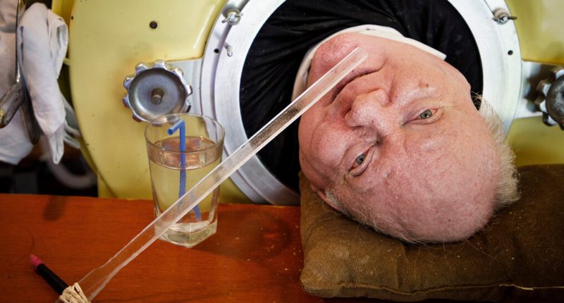Paul Alexander, Polio Survivor Who Lived in Iron Lung for 70 Years, Dies age 78