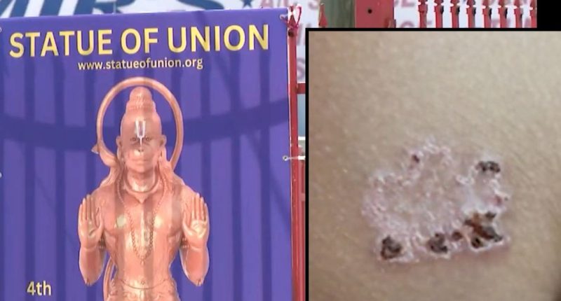 Father says 11-year-old son was branded with hot iron in religious ceremony at Hindu temple in Texas without his approval