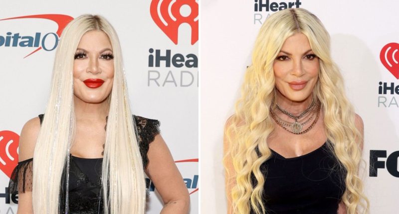 Tori Spelling Weight Loss Transformation: Before, After Photos