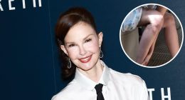Ashley Judd Recalls Leg Injury That Almost Led to Amputation