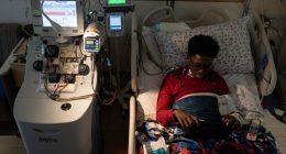 First Patient Begins Sickle Cell Gene Therapy That F.D.A. Approved