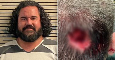 Florida man bit chunk out of deputy's head at music festival: sheriff's office