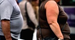 Obesity and low productivity in the UK go hand in hand, think-tank warns