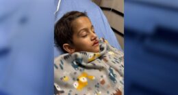 Florida boy has open heart surgery after being hit by drone at holiday show, parents say