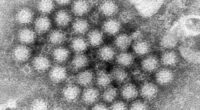 Nasty norovirus is back in full force with US cases of the stomach virus surging