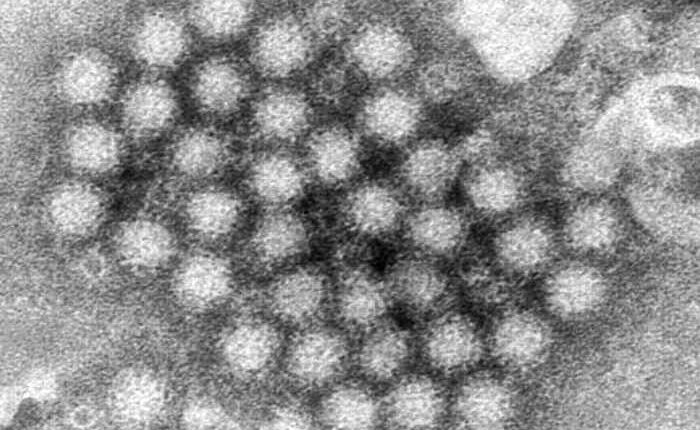 Nasty norovirus is back in full force with US cases of the stomach virus surging