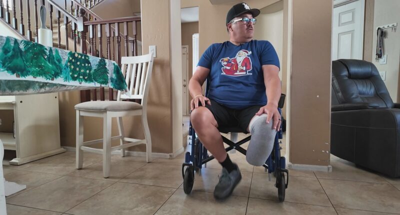 West Valley nurse loses his leg after contracting rare bacterial infection while on vacation