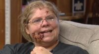 Woman reveals chilling last thought before EIGHT pit bulls tore her apart and left her needing 180 stitches