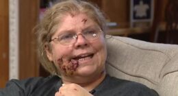 Woman reveals chilling last thought before EIGHT pit bulls tore her apart and left her needing 180 stitches