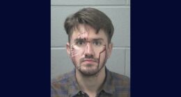 Man cut own face so he could blame girlfriend: Police