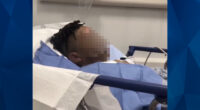 Prank Gone Bad? 12-Year-Old Boy Has Boiling Water Poured on Face at Sleepover