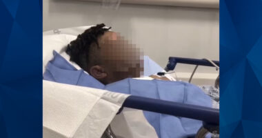 Prank Gone Bad? 12-Year-Old Boy Has Boiling Water Poured on Face at Sleepover