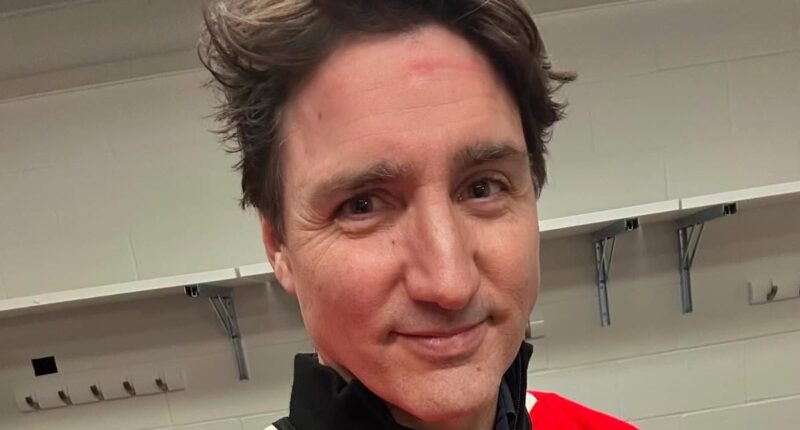 Humiliation for Justin Trudeau as USA smokes Canada in brutal hockey game after players brawled over National Anthem attack