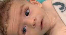 Subtle sign in baby's eyes that revealed he had brain cancer... in video taken just one day before diagnosis