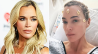 Teddi Mellencamp Battles Multiple Brain Tumors Shaves Head Ahead Surgery