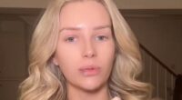 Lottie Moss reveals 'new face' in emotional update after having 'awful' jaw and lip filler dissolved and tattoo removed