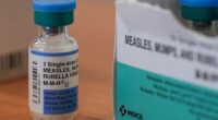 Measles cases are still rising in Texas. Here's what you should know about the contagious virus