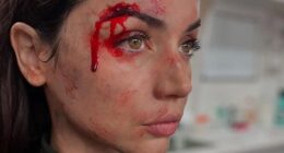 Ana de Armas shows off bloody face gash on ‘Ballerina’ set and more star snaps