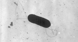 At least 10 people sickened in US listeria outbreak linked to prepared foods
