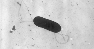 At least 10 people sickened in US listeria outbreak linked to prepared foods