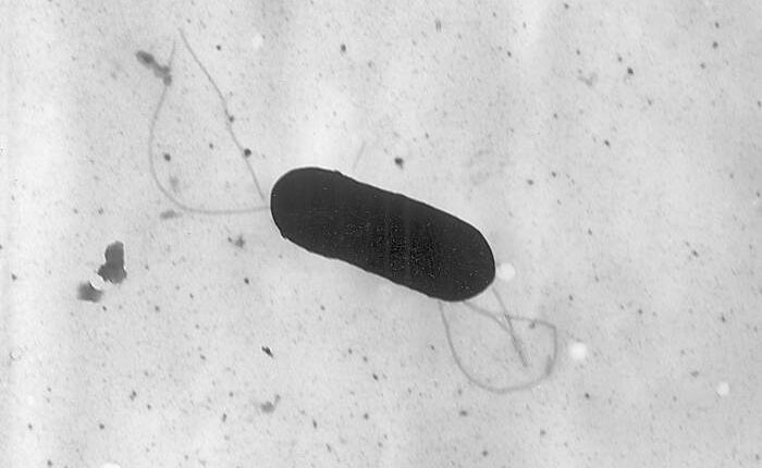 At least 10 people sickened in US listeria outbreak linked to prepared foods