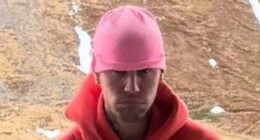 Glaring detail in Justin Bieber snaps sparks concerns over drug use
