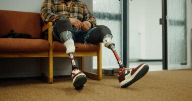 Illinois prosthetics service seeks to help those with limb loss throughout lives