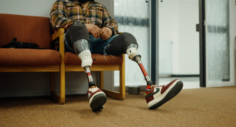 Illinois prosthetics service seeks to help those with limb loss throughout lives
