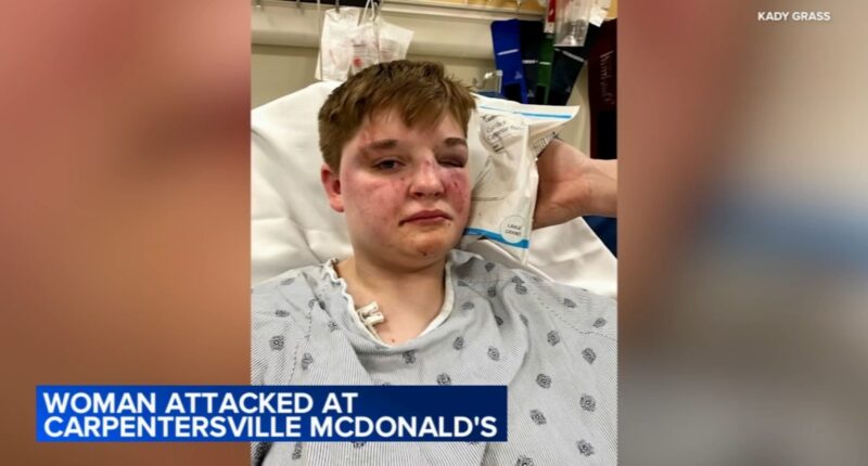 Kady Grass seriously injured, knocked unconscious in allegedly homophobic McDonald's attack in Carpentersville, Illinois