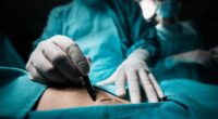 REVEALED: The US states where doctors are most likely to bungle your surgery