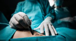 REVEALED: The US states where doctors are most likely to bungle your surgery