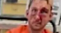 Road-rager Nathaniel Radimak left bloodied in prison ‘assault’ after ‘lashing out at teen learning to park’
