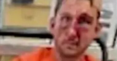 Road-rager Nathaniel Radimak left bloodied in prison ‘assault’ after ‘lashing out at teen learning to park’