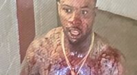 Shocking pictures show Tory Lanez covered in blood after being stabbed 14 times inside California prison where he is serving ten years for shooting Megan Thee Stallion