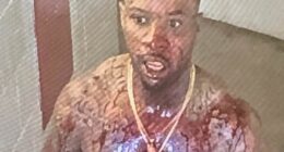 Shocking pictures show Tory Lanez covered in blood after being stabbed 14 times inside California prison where he is serving ten years for shooting Megan Thee Stallion