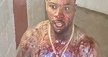 Shocking pictures show Tory Lanez covered in blood after being stabbed 14 times inside California prison where he is serving ten years for shooting Megan Thee Stallion