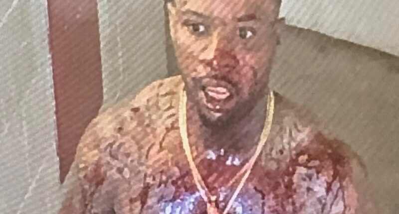 Shocking pictures show Tory Lanez covered in blood after being stabbed 14 times inside California prison where he is serving ten years for shooting Megan Thee Stallion
