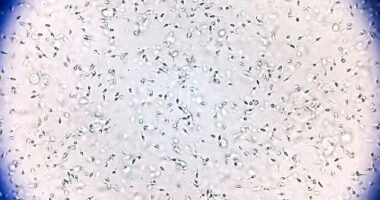 Sperm from the donor was used to conceive at least 67 children from 46 families.