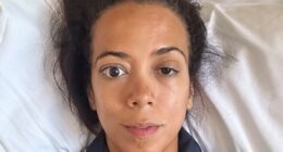 The shocking rise of bulging eyes in women over 40 - as doctors reveal the very common symptoms thousands can't afford to ignore
