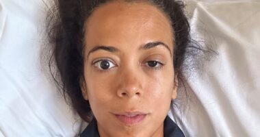 The shocking rise of bulging eyes in women over 40 - as doctors reveal the very common symptoms thousands can't afford to ignore