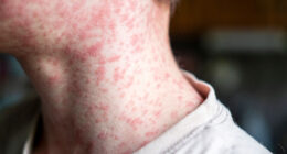 US airport ranked among busiest in world is put on red alert after 3 passengers catch Earth’s most infectious disease