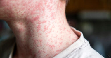 US airport ranked among busiest in world is put on red alert after 3 passengers catch Earth’s most infectious disease