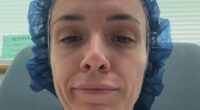 Woman reveals how a simple splinter led to years of excruciating pain and seizures