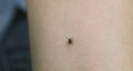 Consumer Reports: How to keep your yard tick-free