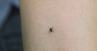 Consumer Reports: How to keep your yard tick-free